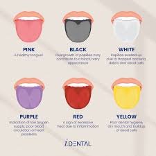 what does your tongue colour mean