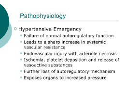 Hypertension Case Study Hypertensive Emergency  