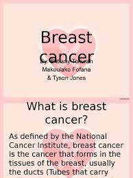 Symptoms more specific to invasive breast cancer are: Breast Cancer Epidemiology Breast Cancer Mammography