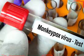 मंकीपॉक्स वायरस पर WHO की रिपोर्ट, जानिए इसके लक्षण