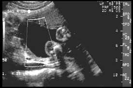 Ultrasound Assessment Of Amniotic Fluid Volume