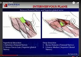 direct anterior approach for total hip