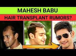 mahesh babu hair transplant or hair