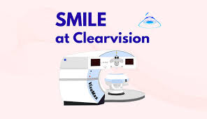 the smile experience clearvision