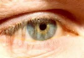 blepharitis family eye care optometry