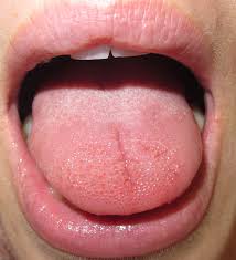 tongue feels