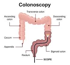 colonoscopy care rule q a and