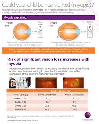 Risks For High Myopia Misight Chart Kodak Lens Vision