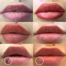 lip blush gone wrong risks side effects