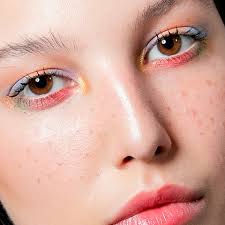dark spots freckles melasma