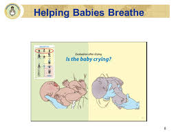 Helping Babies Breathe Ppt Video Online Download