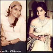 Sonam Kapoor Weight Loss Story Diet Workouts And Before