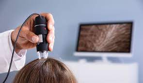 head lice and hair color