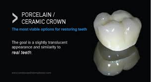 Crowns Common Materials Used For Making Dental Crowns