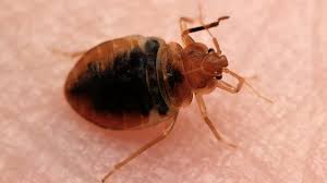 here s how to treat bed bug bites