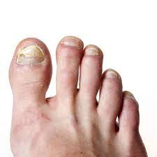 ed toenails feet first clinic