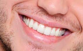 3 طرق طبيعية لتبييض الاسنان | Rajil