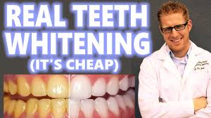 teeth whitening at home how to