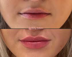 women with thin lips look objectively