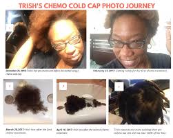 chemo hair loss journey
