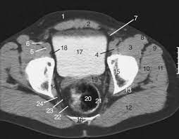 the pelvis radiology key