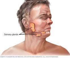 salivary gland tumors disease reference