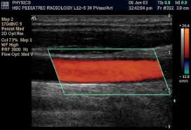 Color Doppler Ultrasound In Pregnancy Color Doppler