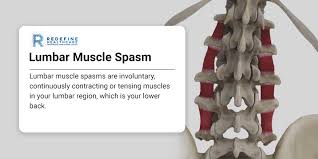 lumbar muscle spasm symptoms causes