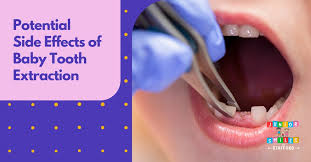 side effects of baby tooth extraction