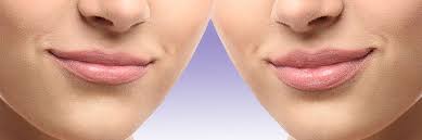 Check spelling or type a new query. Botox Injection Treatments Kittery Remove Wrinkles Forehead Lines Crows Feet
