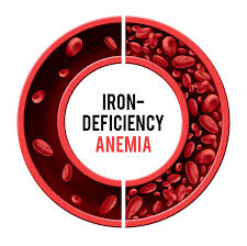 Indications Of Iron Deficiency