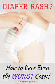 how to cure even the worst diaper rash