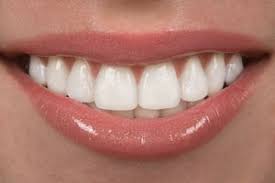 best cosmetic dentists in palm beach