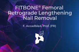 fitbone fem retrograde lengthening