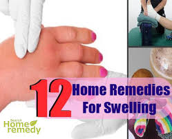 12 home remes for swelling