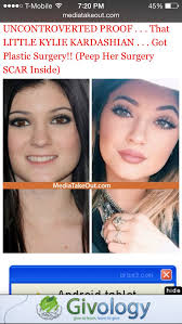how a nose job can change the shape of