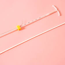iud types how to choose the best iud