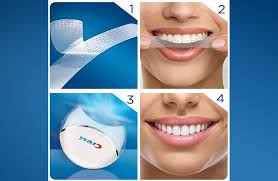brush your teeth after whitening strips