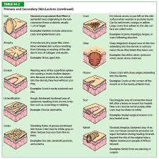 Download Image Types Of Primary Skin Lesions Chart Pc