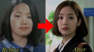 While it's true that tons of celebs have had plastic surgery—and will admit to it—not all famous people are super open about it, leaving us to wonder if they did, in fact, go under the knife. 10 Korean Celebrities Who Have Admitted To Plastic Surgery Youtube