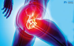 Hip Replacement Surgery Cost in India | Mewar Hospitals