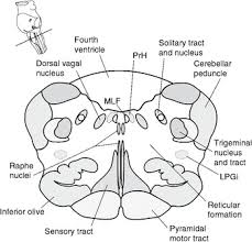 Neurological lesion identification motor (corticospinal pathway) localises the lesion to the contralateral medial brainstem. Brainstem Chapter 10 The Brain And Behavior