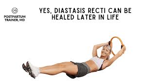 heal diastasis recti