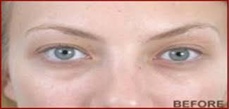 permanent makeup red laser beauty