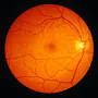 Retina anatomy from www.verywellhealth.com