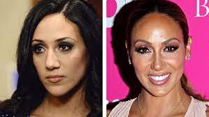real housewives cosmetic surgery