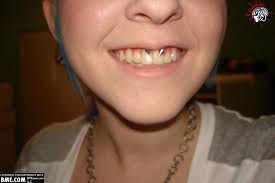 There were times when smiley piercing was considered a taboo before we discuss how the procedure is performed, i must stress that i recommend you have this procedure done by a professional piercer. Retired Smiley Piercing Piercing Body Modifications