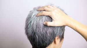 Niacin (vitamin b3) helps scalp circulation. Reverse Gray Hair Remedies And Vitamins