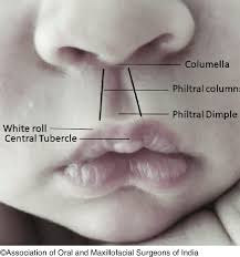 5 surface landmarks of a normal lip and