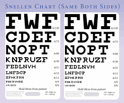 Pin On Snellen Charts Printable